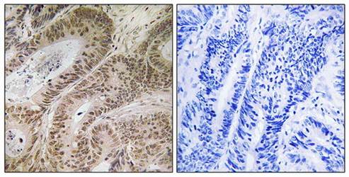 RDM1 Antibody