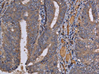 REG3G Antibody