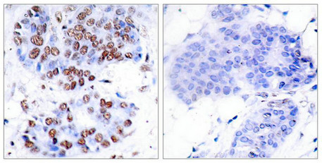 RELA Antibody