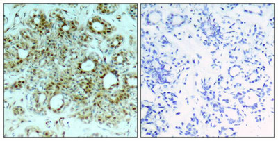 RELA Antibody