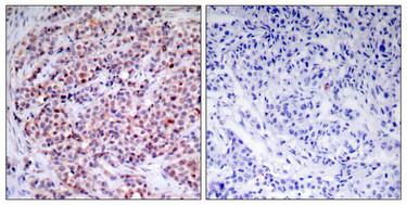 RELA Antibody