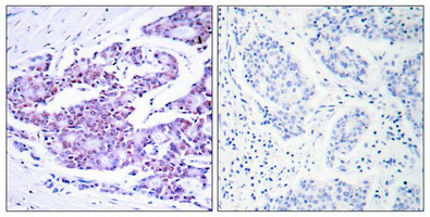 RELA Antibody