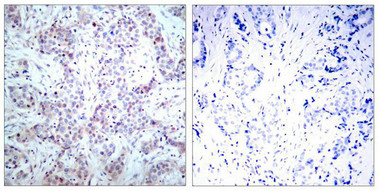 RELA Antibody