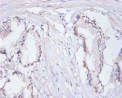 RPA3 Antibody