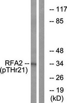 RFA2 (Phospho-Thr21) Antibody