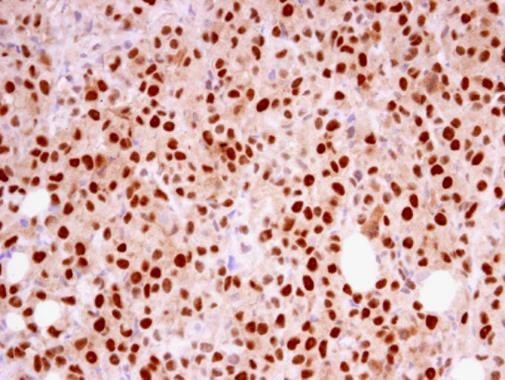 replication factor C subunit 4 Antibody