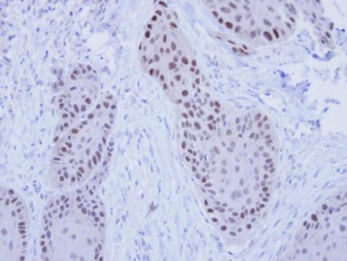 replication factor C subunit 4 Antibody