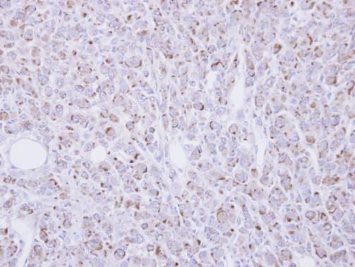 RGMB Rabbit Polyclonal Antibody