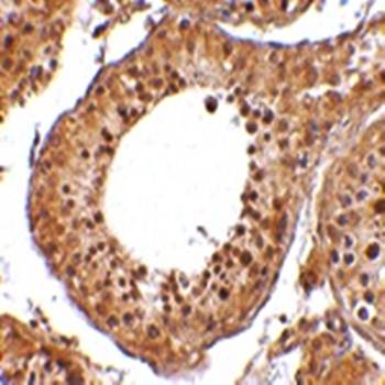 RGPD5 Rabbit Polyclonal Antibody