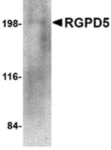 RGPD5 Rabbit Polyclonal Antibody