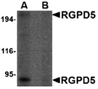 RGPD5 Rabbit Polyclonal Antibody