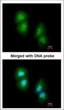RGS13 Rabbit Polyclonal Antibody