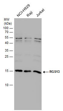 RGS13 Rabbit Polyclonal Antibody