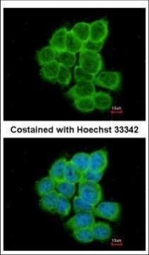 RGS17 Rabbit Polyclonal Antibody