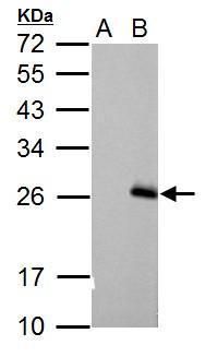 RGS17 Rabbit Polyclonal Antibody