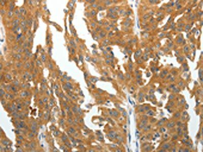 RGS2 Antibody