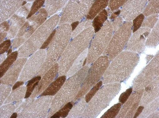 RGS4 Rabbit Polyclonal Antibody