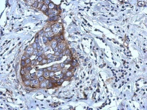 RGS4 Rabbit Polyclonal Antibody