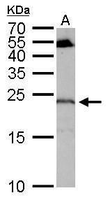 RGS4 Rabbit Polyclonal Antibody