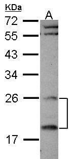 RGS4 Rabbit Polyclonal Antibody