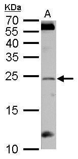 RGS4 Rabbit Polyclonal Antibody