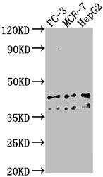 RHBDD3 Antibody