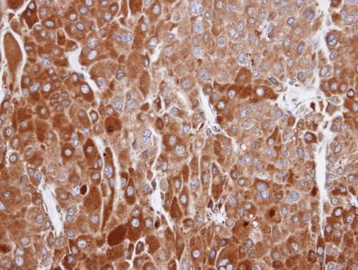 RIC8A Rabbit Polyclonal Antibody