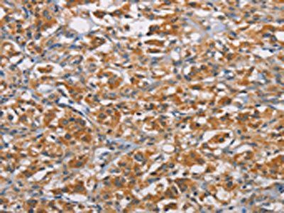 RICTOR Antibody