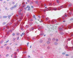 RICTOR Antibody