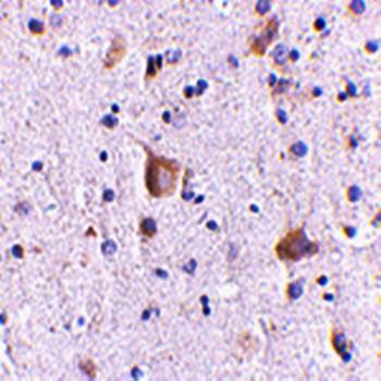 Rim2 Rabbit Polyclonal Antibody