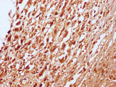 RNF20 Antibody