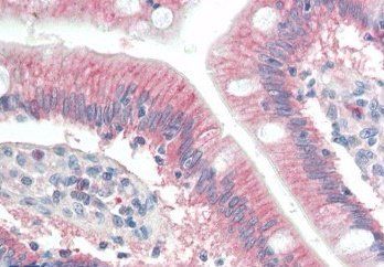 RNF39/LIRF Antibody
