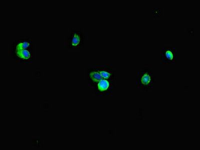 RNF4 Antibody
