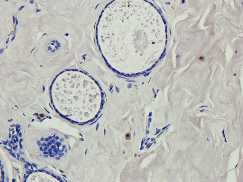 RNF4 Rabbit Polyclonal Antibody