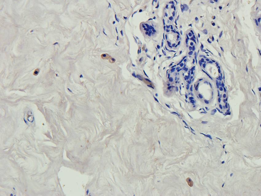 RNF4 Rabbit Polyclonal Antibody