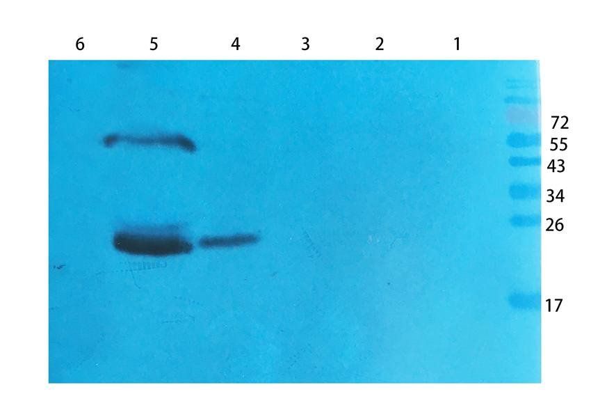 RNF4 Rabbit Polyclonal Antibody