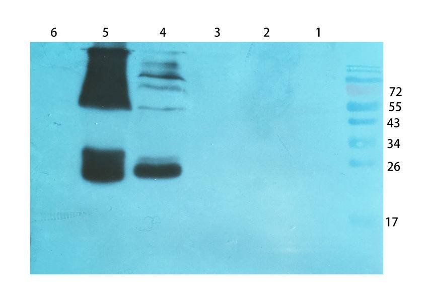 RNF4 Rabbit Polyclonal Antibody