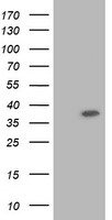 TRIM2 Antibody