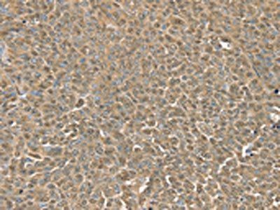 RNH1 Antibody
