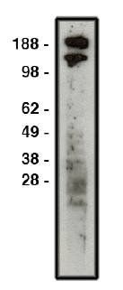 Rabbit Human Roundabout homolog 1, ROBO1 Antibody