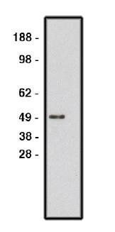 Rabbit Human Roundabout homolog 1, ROBO1 Antibody