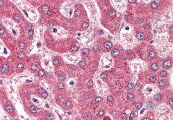ROBO1/DUTT1 (Internal) Antibody
