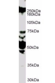 ROBO1/DUTT1 (Internal) Antibody