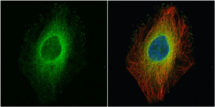 ROCK1 Rabbit Polyclonal Antibody