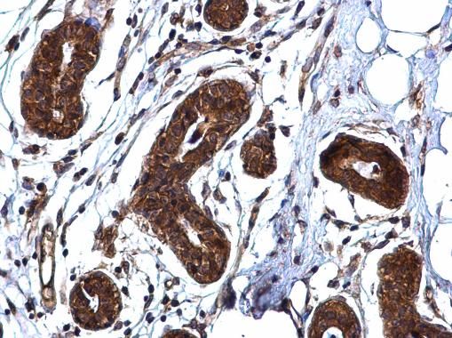 ROCK1 Rabbit Polyclonal Antibody