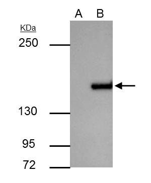 ROCK1 Rabbit Polyclonal Antibody