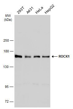 ROCK1 Rabbit Polyclonal Antibody