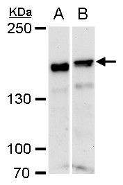 ROCK1 Rabbit Polyclonal Antibody