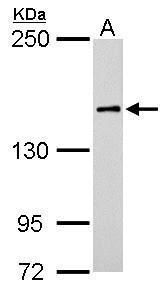 ROCK1 Rabbit Polyclonal Antibody