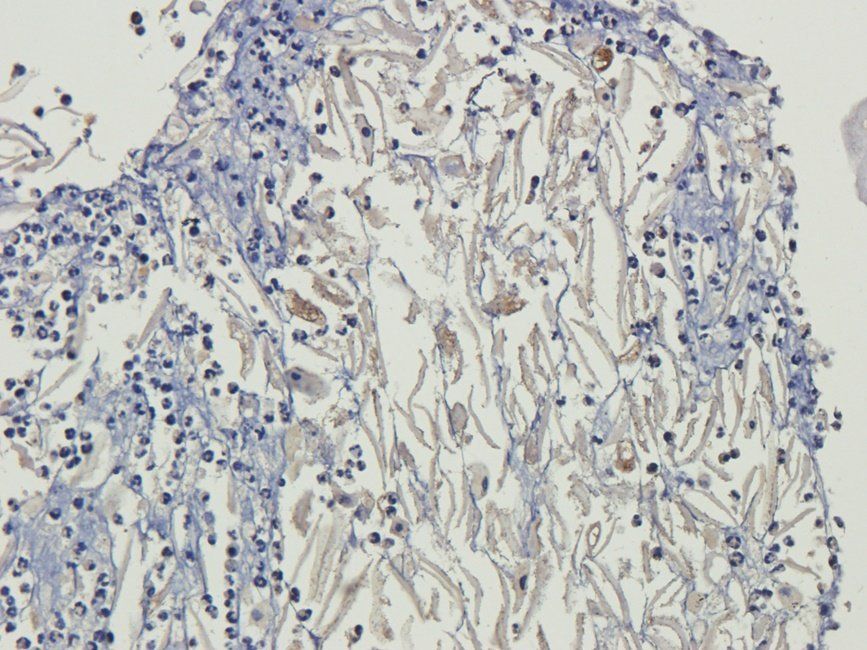 ROCK2 Rabbit Polyclonal Antibody